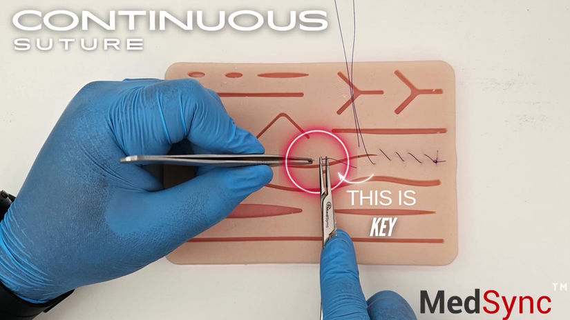 Continuous suture